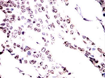 HMGA1 Antibody