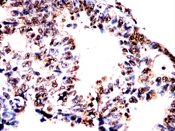 HMGA1 Antibody
