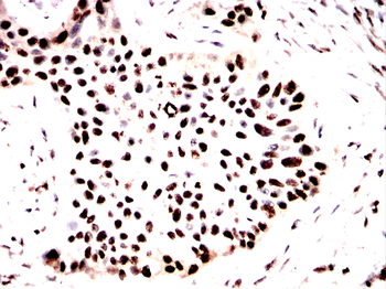 HMGA1 Antibody