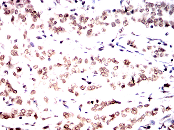 HMGA1 Antibody