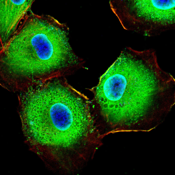 HMGA1 Antibody