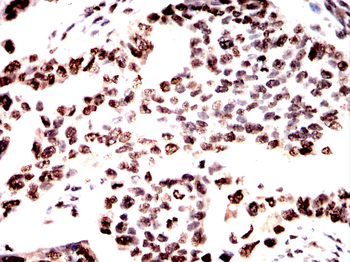 HMGA1 Antibody