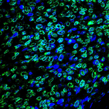 HMGA1 Antibody