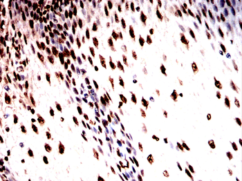HMGA1 Antibody