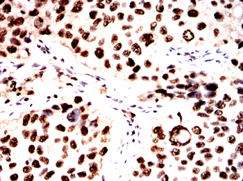HMGA1 Antibody