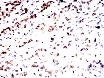 HMGA1 Antibody