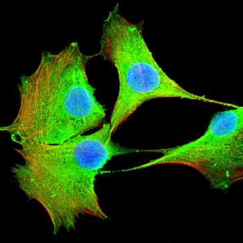 BCKDHA Antibody