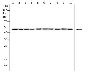 BCKDHA Antibody