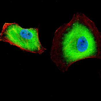 BCKDHA Antibody