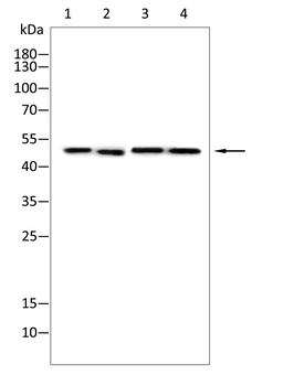BCKDHA Antibody