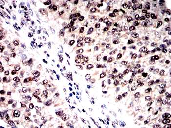 DUSP16 Antibody