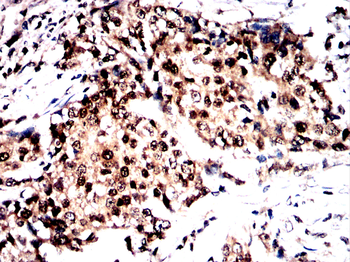 DUSP16 Antibody
