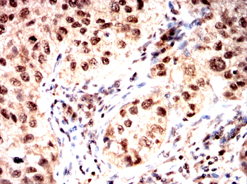 DUSP16 Antibody