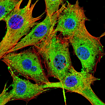 ACLY Antibody