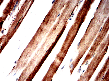 ACLY Antibody