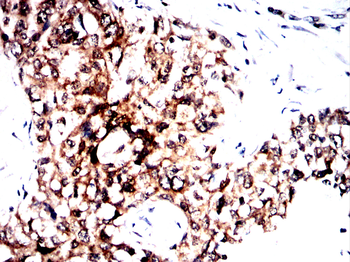 ACLY Antibody