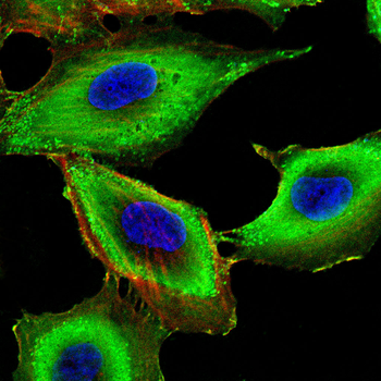 ACLY Antibody