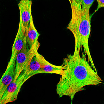 FGFR4 Antibody