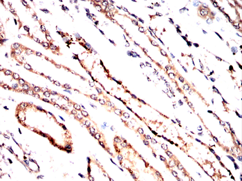 FGFR4 Antibody