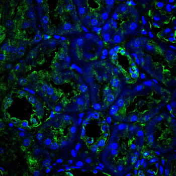 FGFR4 Antibody