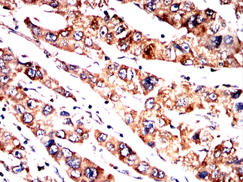 FGFR4 Antibody