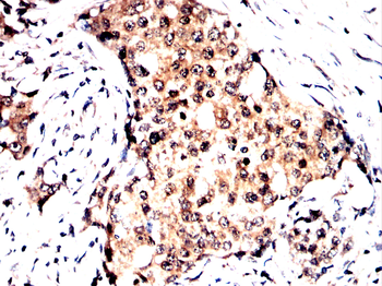 FGFR4 Antibody