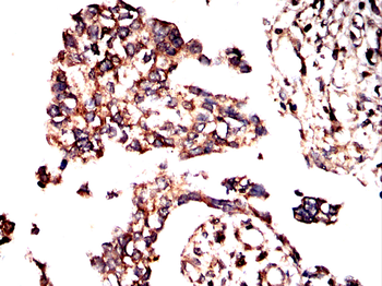 FGFR4 Antibody
