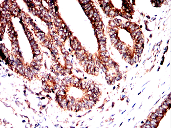FGFR4 Antibody