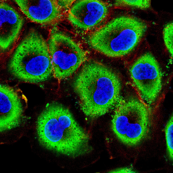 TRIM72 Antibody