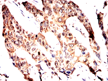 ASRGL1 Antibody