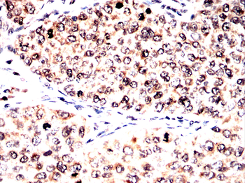 ASRGL1 Antibody
