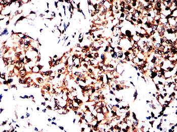 ASRGL1 Antibody