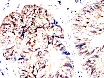 ASRGL1 Antibody