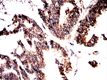 ASRGL1 Antibody