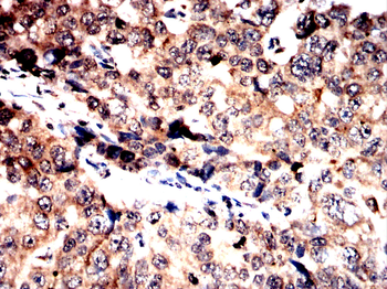 ASRGL1 Antibody