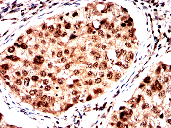ASRGL1 Antibody