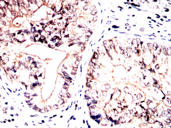 ASRGL1 Antibody