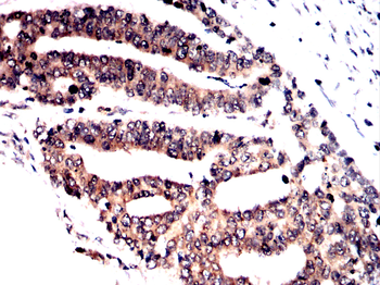 SPHK2 Antibody