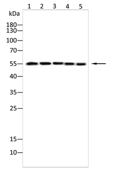 SPHK2 Antibody