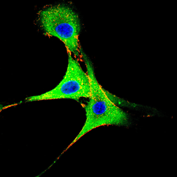 SPHK2 Antibody