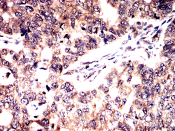 SPHK2 Antibody