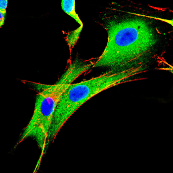 DDR1 Antibody