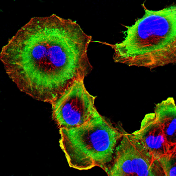 SLC16A3 Antibody