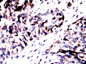 SLC16A3 Antibody