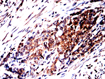 SLC16A3 Antibody