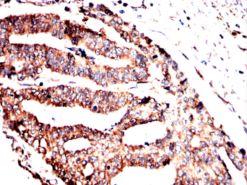 SLC16A3 Antibody