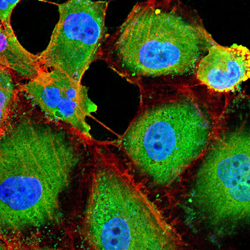 TMED5 Antibody