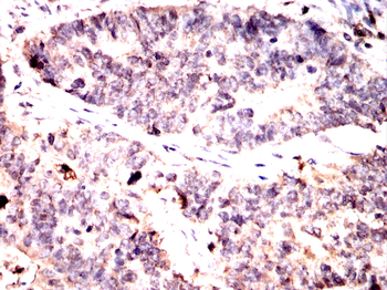 UCHL1 Antibody