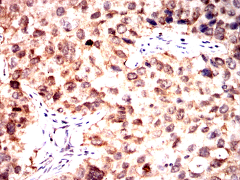 UCHL1 Antibody