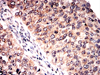 PVALB Antibody